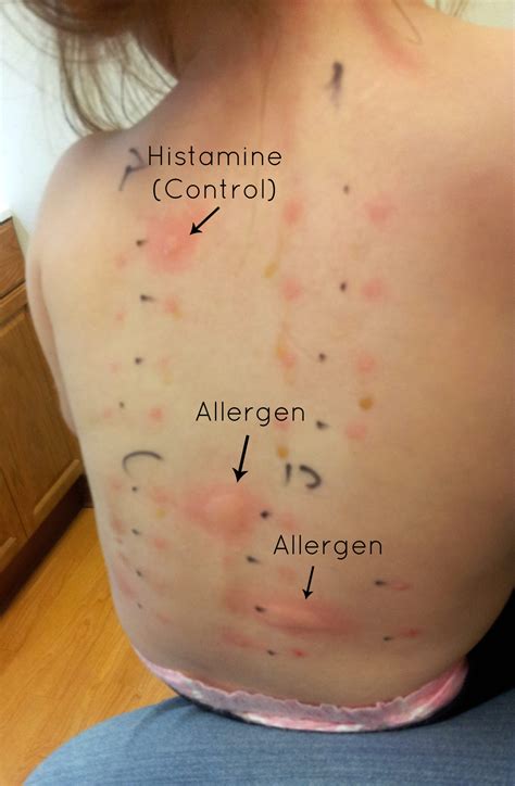 How To Address Skin Allergies And Sensitivities?